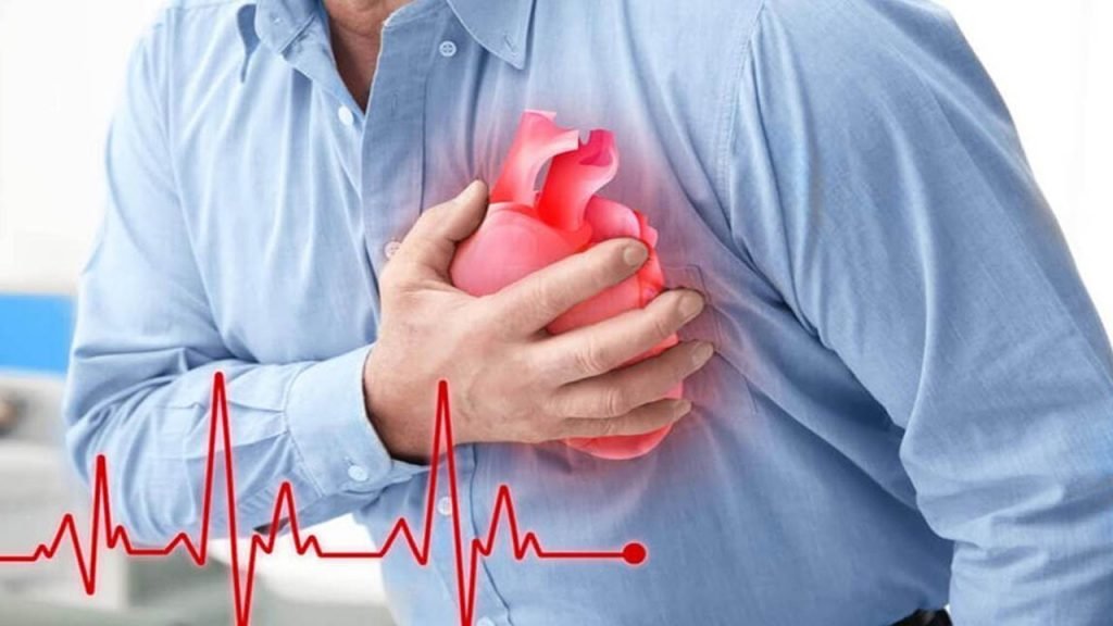Cardiac Arrest