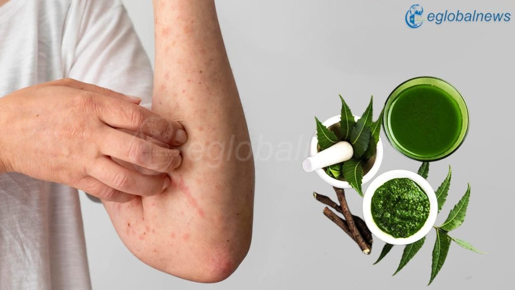 Some home tips on skin allergy