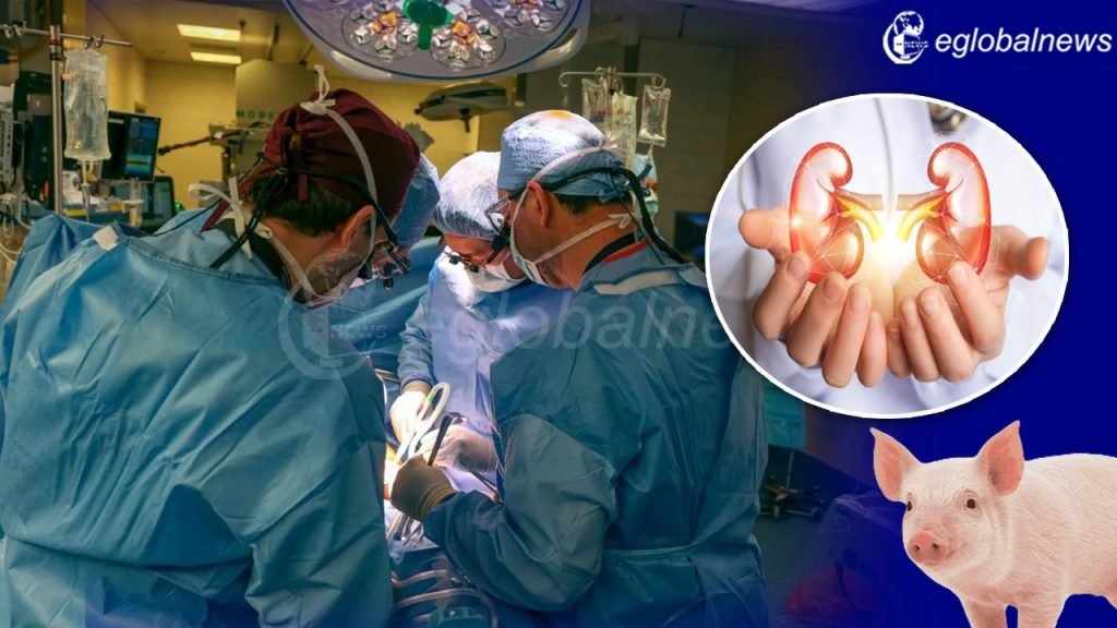 Kidney Transplant: