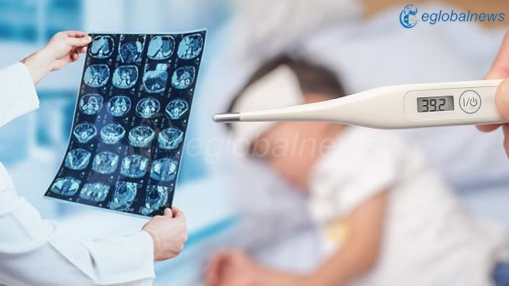 Acute Encephalitis Syndrome: